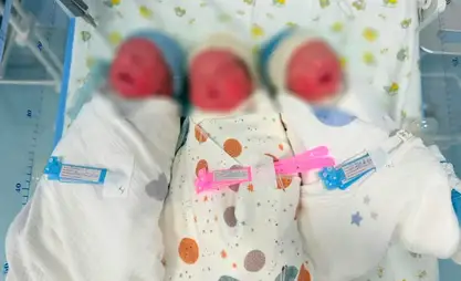 В НЦОМиД успешно провели сложные роды: родились трое детей