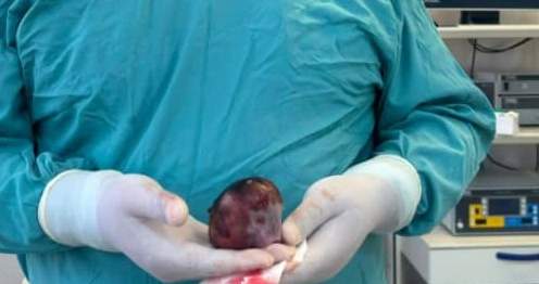 Фото: Кабар (рус.)