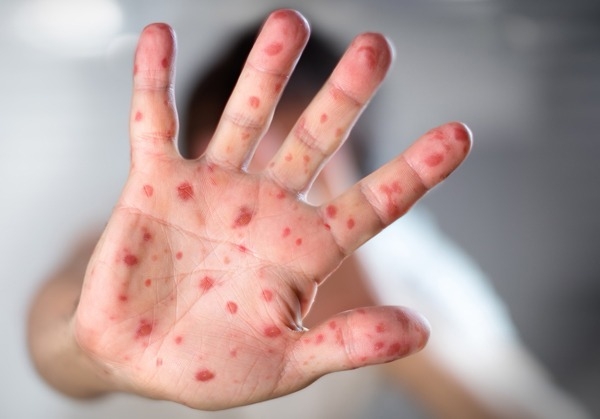 WhatsApp Image 2026-03-03 at 18.17.31 (2).jpeg