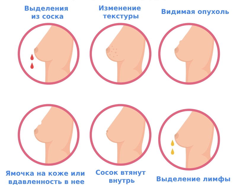 rak-grudi-simptomy.jpg